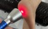 Laser Therapy: High Intensity for Effective Treatment