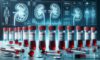Kidney Blood Test: Essential Insights for Blackburn Residents