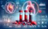 Cholesterol Blood Test: Your Essential Health Guide in Milton Keynes